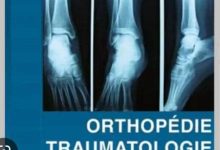 Fin décembre 2022, l’établissement public , CHP Notsè a inauguré le service d’orthopédie et de traumatologie.