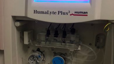 Le Centre Hospitalier préfectoral de Notsè (CHP situé à 96 km au nord de Lomé) vient de s’équiper d’un nouvel automate de biochimie